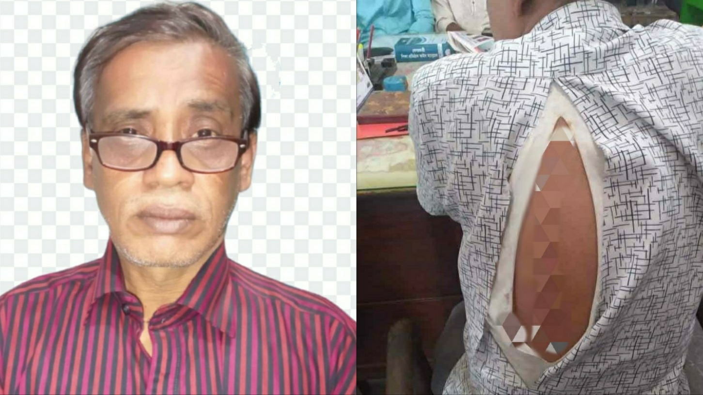 বেলাবতে কলেজে যাওয়ার পথে শিক্ষককে ছুরিকাঘাত