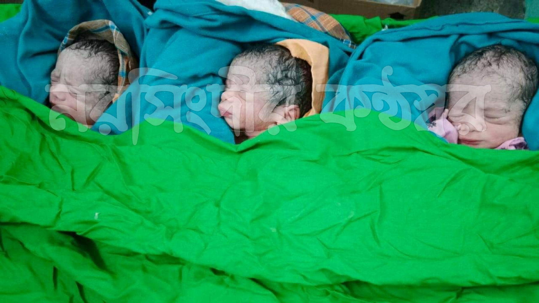 পলাশে এক নারীর একসাথে ৩ সন্তানের জন্ম